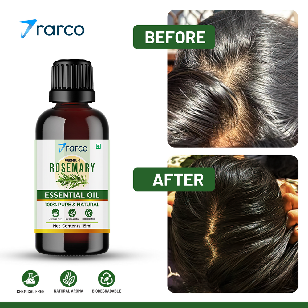 RARCO Rosemary Essential Oil 15 ML for Hair Growth, Skin & Scalp