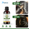 RARCO Rosemary Essential Oil 30 ML for Hair Growth, Skin & Scalp