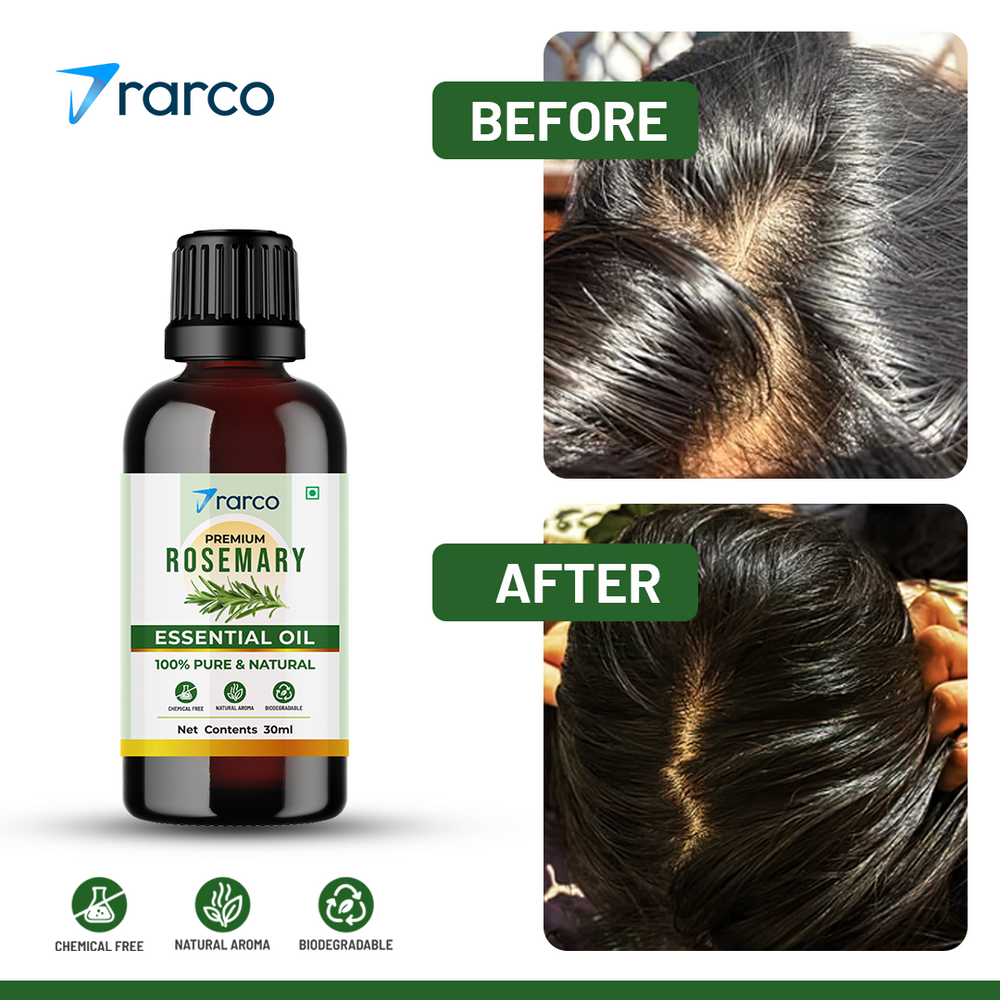 RARCO Rosemary Essential Oil 30 ML for Hair Growth, Skin & Scalp